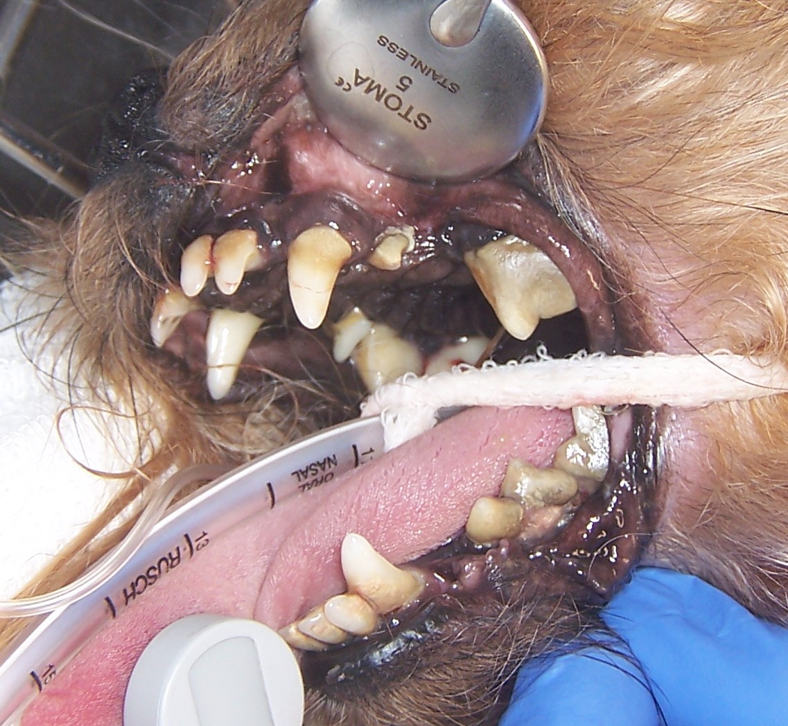 Foto efecto sistémico de la enfermedad periodontal